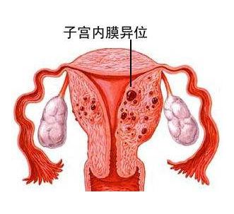 昆明送子鸟医院